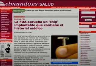 FDA aprueba chip